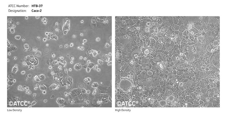 Caco-2细胞(来源--ATCC).jpg Caco-2细胞(来源--ATCC).jpg