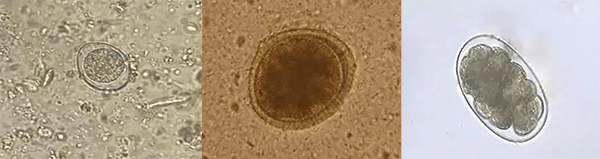 形态学检测-粪便寄生虫检查.png 形态学检测-粪便寄生虫检查.png